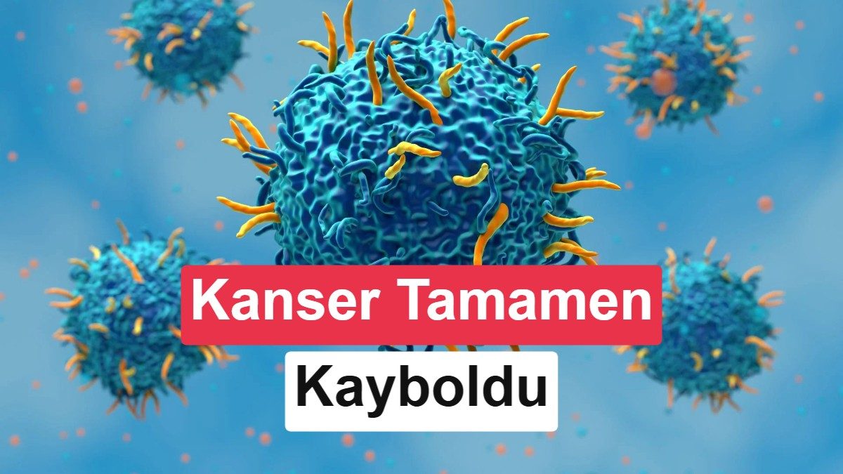 karaciğer kanseri tedavisi ile 3 yaşındaki çocuğun sağlığına kavuşması