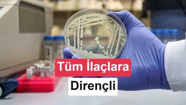 Candidozyma auris mantarının tüm antifungal ilaçlara dirençli varyantı