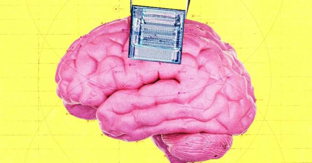 OpenAI'nin beyin implantı ile kanser tespiti projesi hakkında bilgi